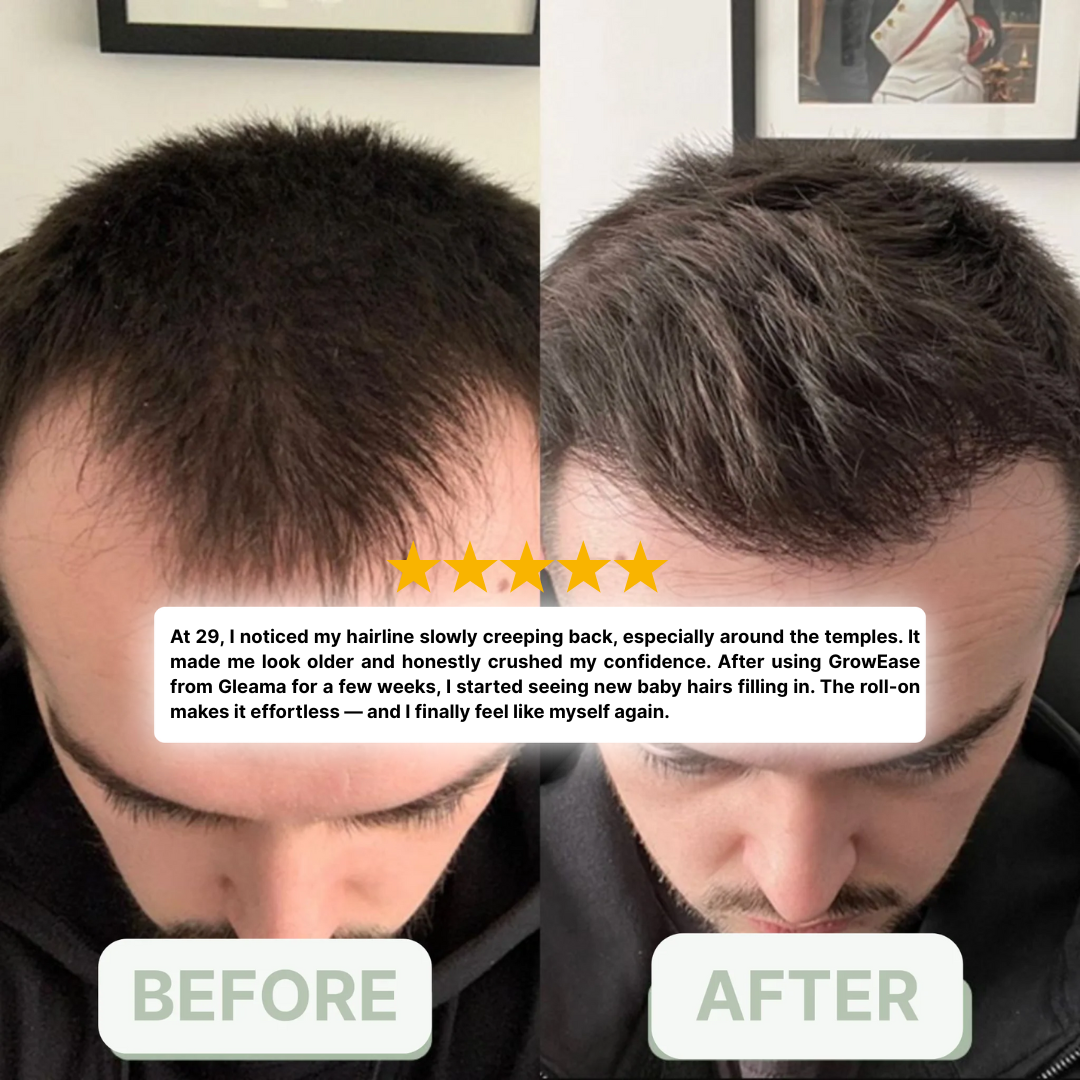 GrowEase™ Hair Growth Serum